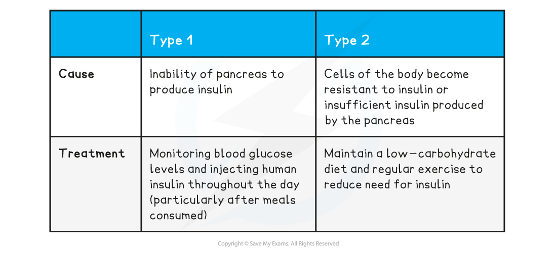 Comparing Type 1 & Type 2 diabete_1, downloadable IGCSE & GCSE Biology revision notes