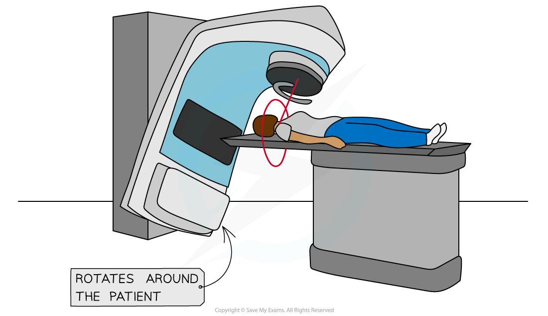 Radiation Therapy 1, downloadable AS & A Level Physics revision notes