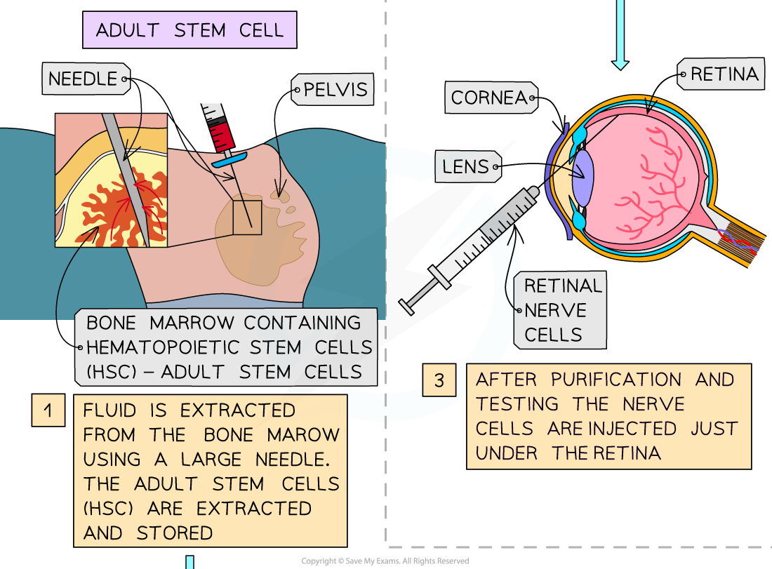 Therapeutic uses of embryonic and adult stem cells 2, downloadable IB Biology revision notes