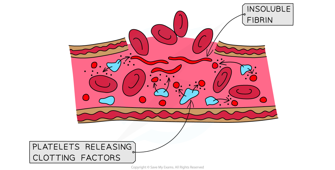 Clotting factors and blood clot formation 2, downloadable IB Biology revision notes