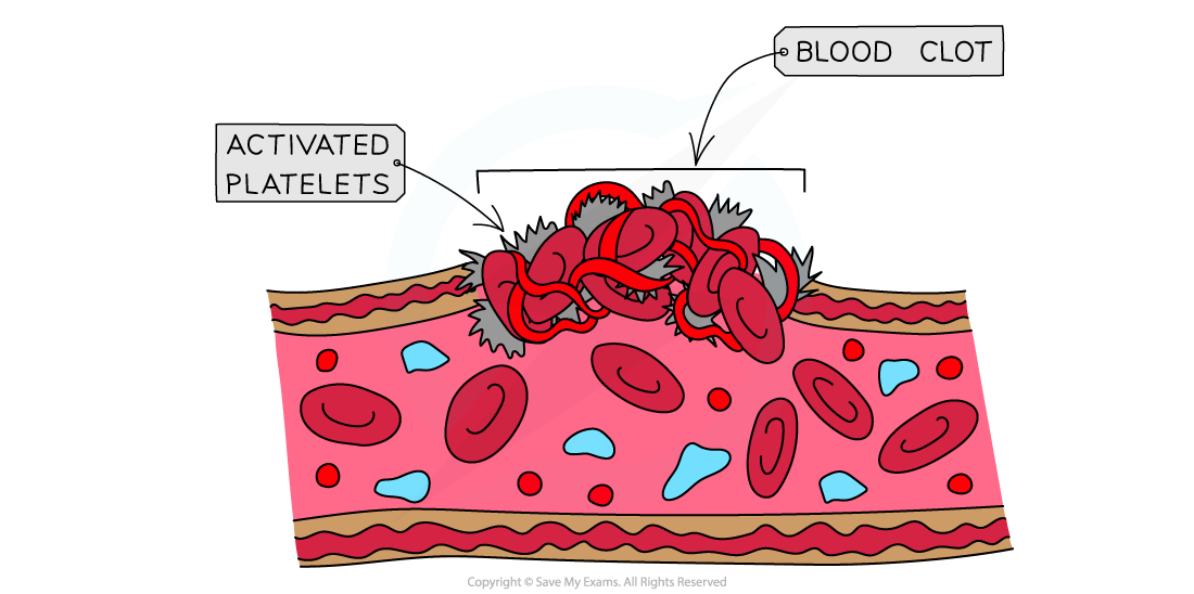 Clotting factors and blood clot formation 3, downloadable IB Biology revision notes